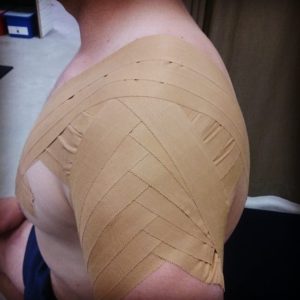 Shoulder taping for sports