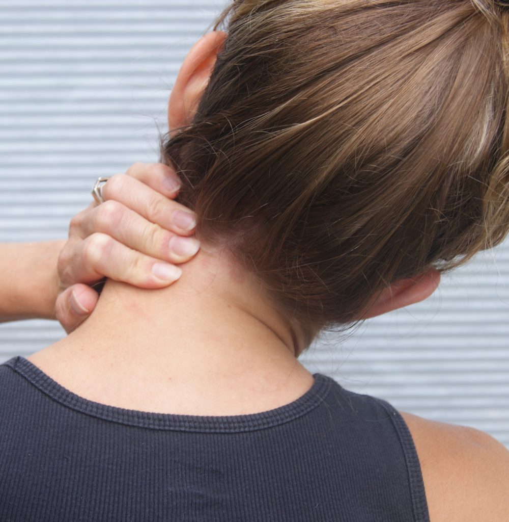 Acute wry neck | Pivotal Motion Physiotherapy