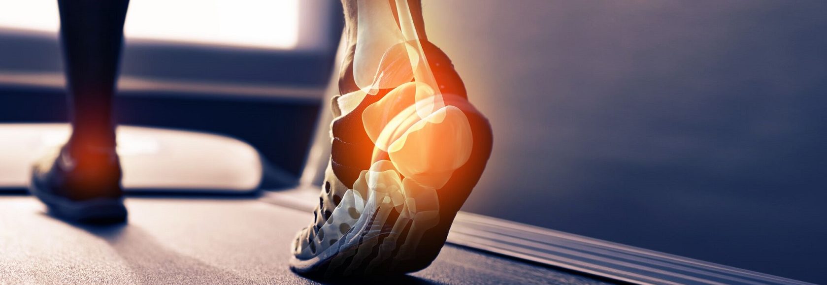 Latest on plantar fasciitis  Pivotal Motion Physiotherapy