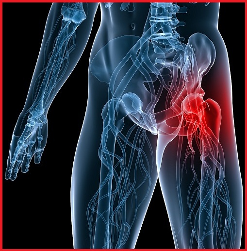 Hip Pain - Recover Physio Hastings