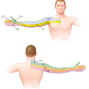 Anatomical drawing indicating dermatomes | Featured image for the Cervical Radiculopathy service page at Pivotal Motion.