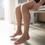 Bare legs of sick male patient sitting on couch in medical office| Featured Image for Identifying Flat Feet and Ankle Pronation | Blog