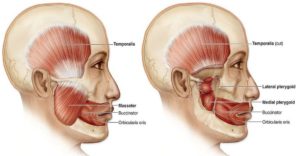 Facial muscles jaw strain | Featured image for Jaw Strain or Jaw Sprain service at Pivotal Motion.