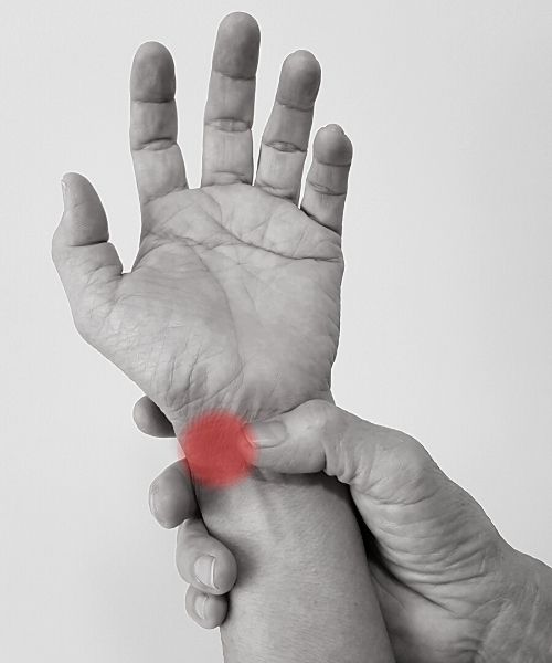 Red dot indicating a problem in the left wrist | featured image for Calcifying Tendinitis.