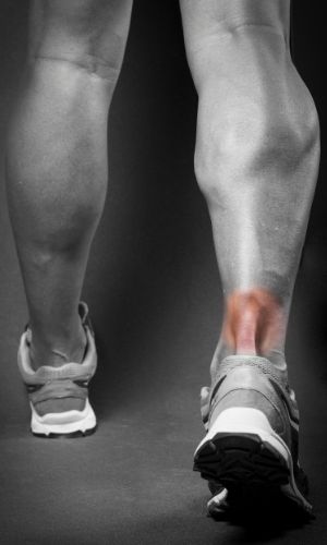 Black and white photograph of a person's legs with red highlight indicating a problem in the Achilles tendon | featured image for Calcifying Tendinitis.