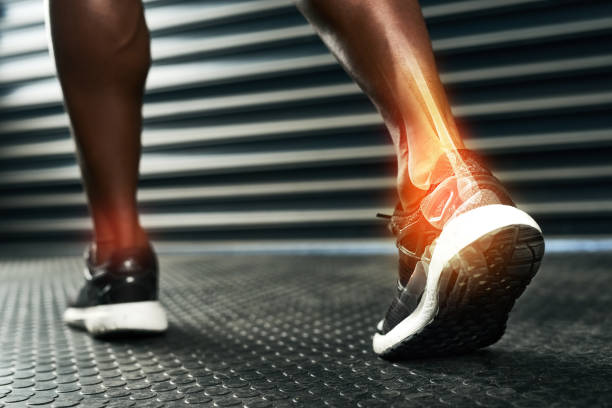 Person's ankle and heel bones highlighted mid step | featured image for Improving Bone Density as You Age blog | Sports Physiotherapy Page from Pivotal Motion Physiotherapy.