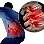 A man clutching his side in pain with an illustration of a close up of his spine | Featured image for Back Injury Physiotherapy.