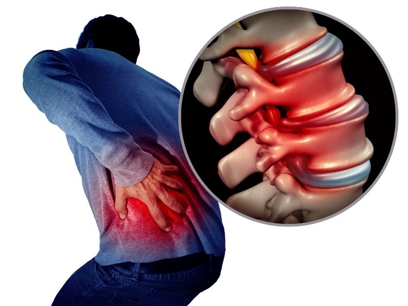 A man clutching his side in pain with an illustration of a close up of his spine | Featured image for Back Injury Physiotherapy.