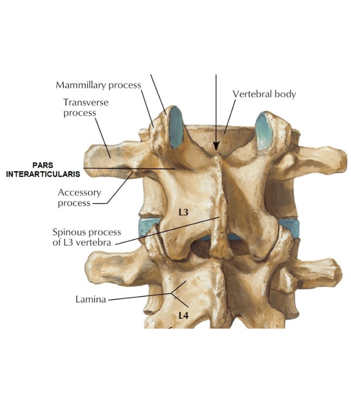 An illustration of bones and spondylolisthesis | Featured image on Spondylolisthesis.