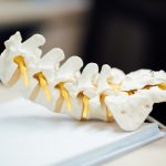 Spine model | Featured image for Have a Slipped Disc?