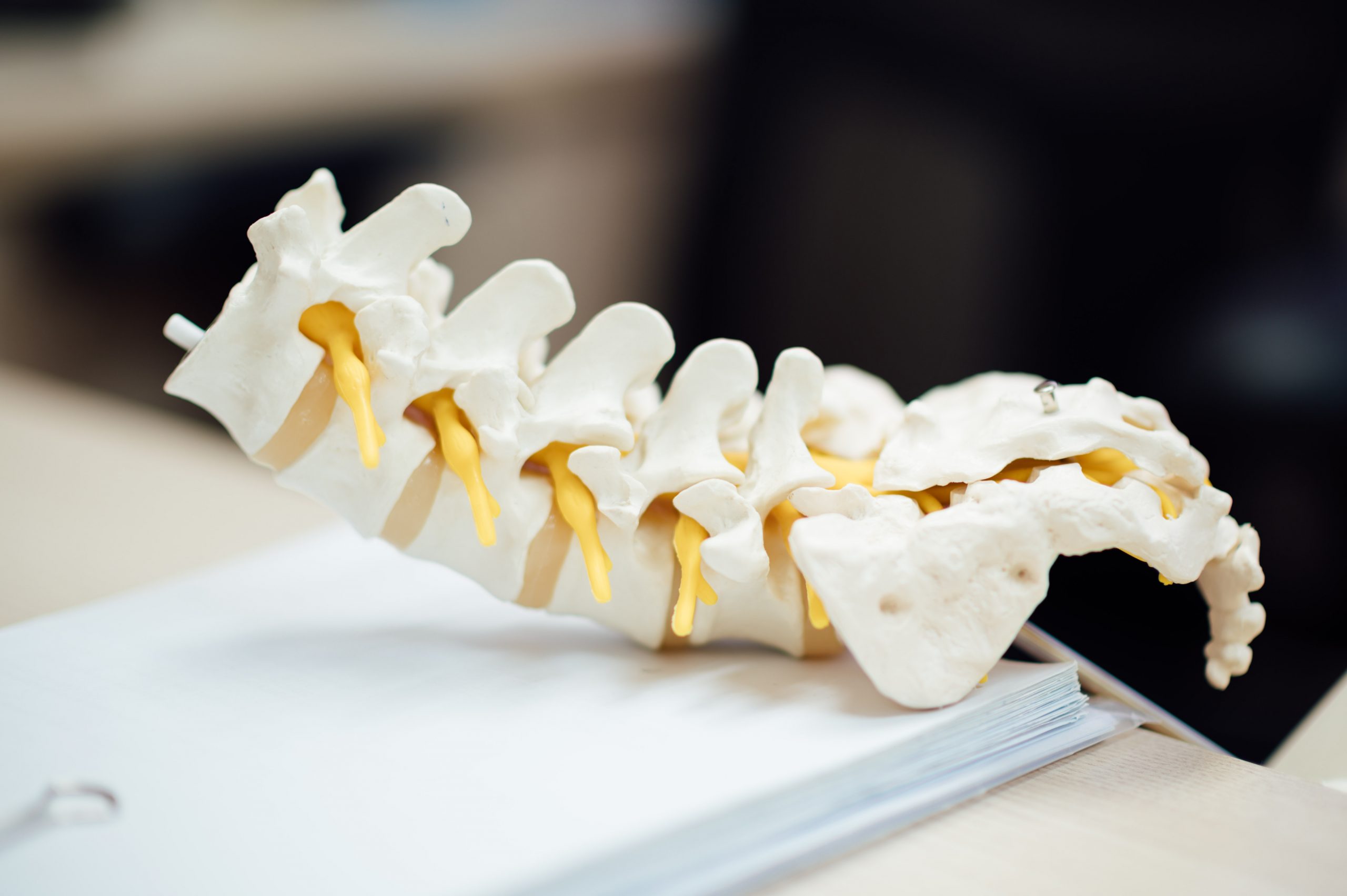 Spine model | Featured image for Have a Slipped Disc?