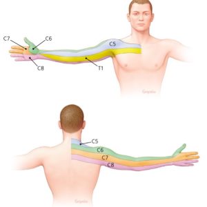 Anatomical drawing indicating dermatomes | Featured image for the Referral Pain and Cervical Radiculopathy page from Pivotal Motion Physiotherapy.